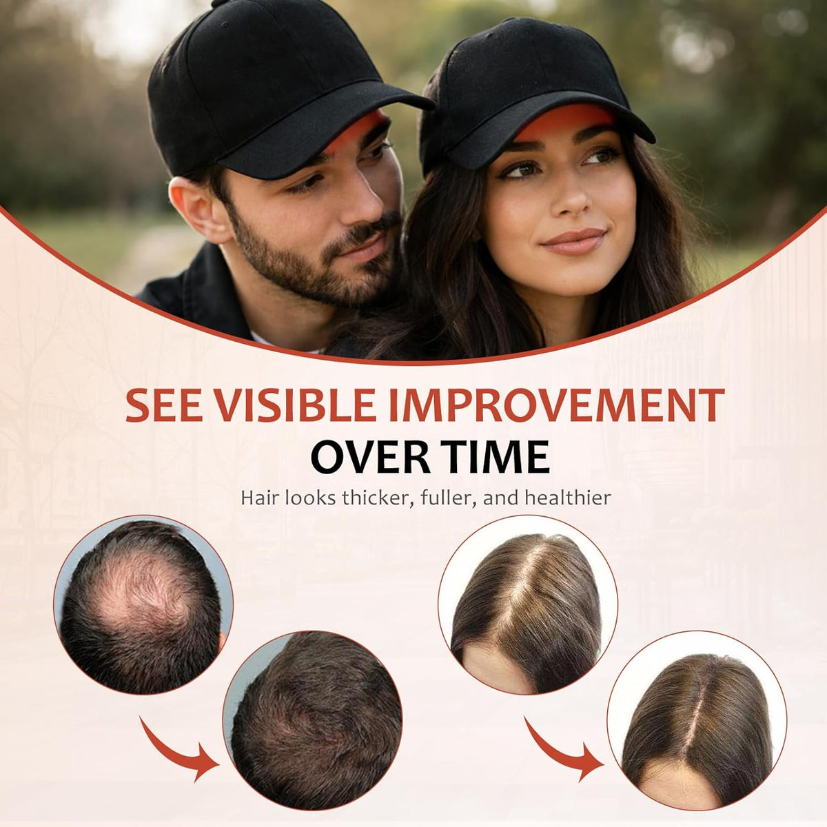 Lumora™ – 650nm Red Light Therapy Hair Growth Cap, Hands-Free & Comfortable + 50% OFF
