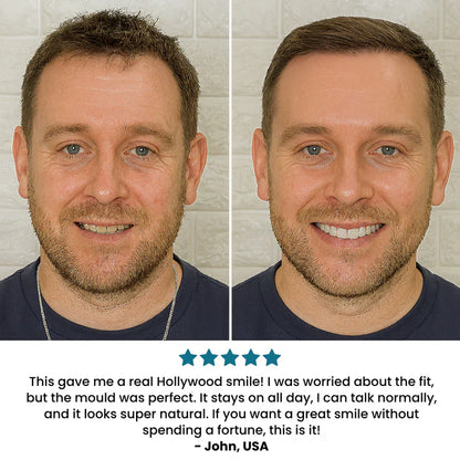 SecureSmile - Achieve a Flawless Smile Instantly - 50% OFF
