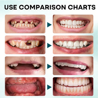 NESLEMY DENTURE-LOCK — SECURE YOUR SMILE ALL DAY — 50% OFF