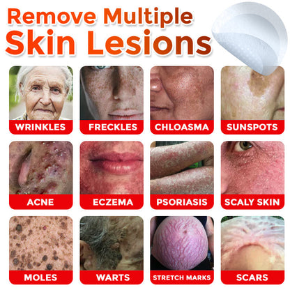 The MicroDerm Patch - Painless Skin Tag & Blemish Removal + 50% OFF