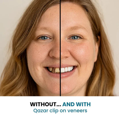 SecureSmile - Achieve a Flawless Smile Instantly - 50% OFF