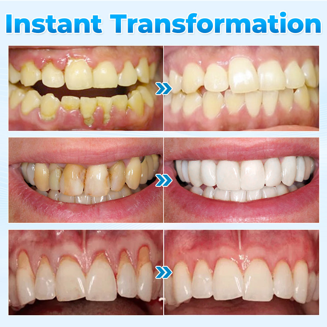 The MicroSmile Gum Restoration Kit - Bee Venom Mousse, Tongue Scraper, and FDA-Approved Healing + 50% OFF