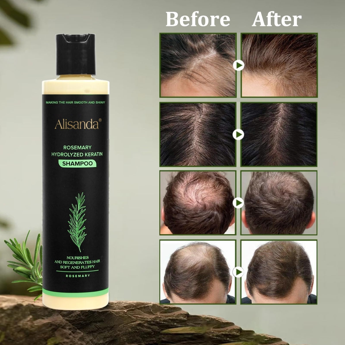 The AuraRoot Rosemary Shampoo - Organic Hair Growth, Hydrolyzed Keratin, and Thickening Formula +  50% OFF