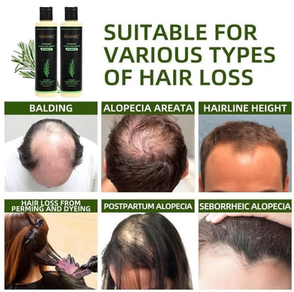The AuraRoot Rosemary Shampoo - Organic Hair Growth, Hydrolyzed Keratin, and Thickening Formula +  50% OFF